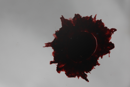 Jellyfish found in the Gulf of Alaska. Credit: Allen Collins