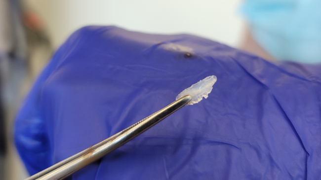 Reid, whose face is out of focus in the background, uses forceps to hold up a small white crystalline structure for the camera. 